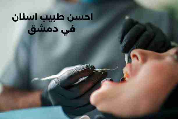 طبيب اسنان في دمشق