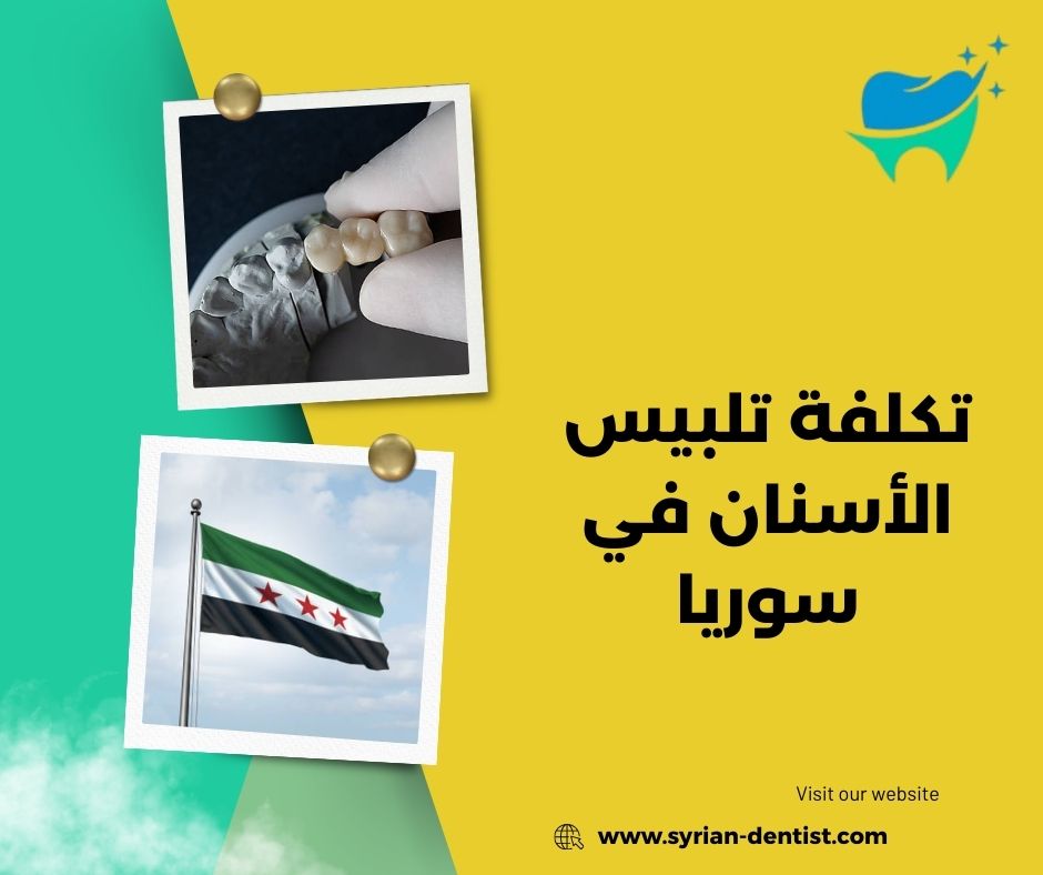 تكلفة تلبيس الأسنان في سوريا