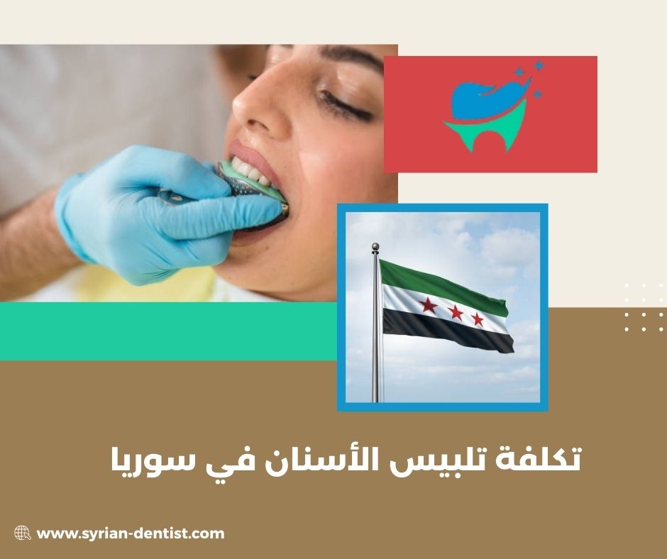 تكلفة تلبيس الأسنان في سوريا