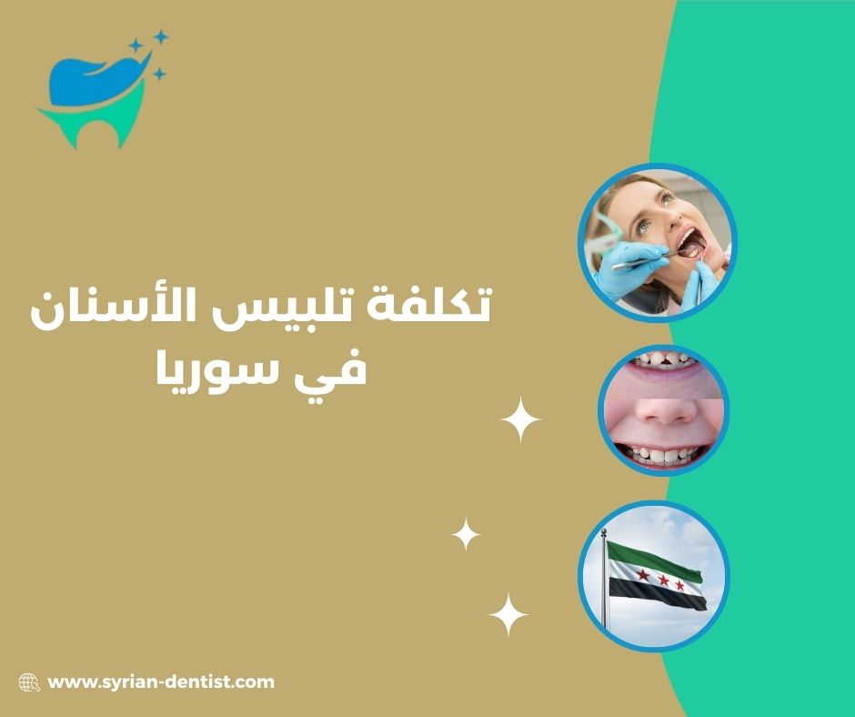 متوسط تكلفة تلبيس الأسنان في سوريا