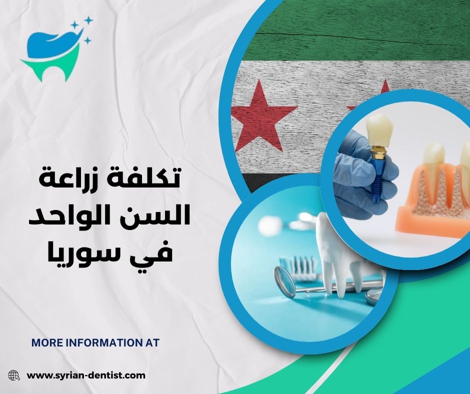 متوسط تكلفة زراعة السن الواحد في سوريا