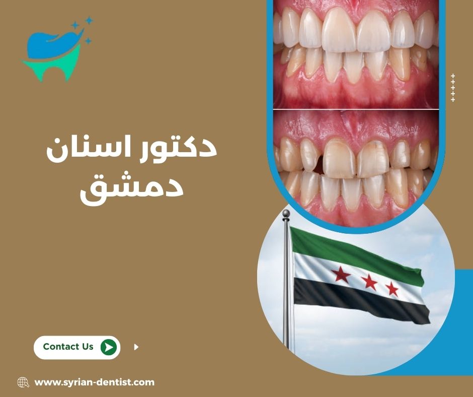 كيف تختار دكتور أسنان في دمشق؟