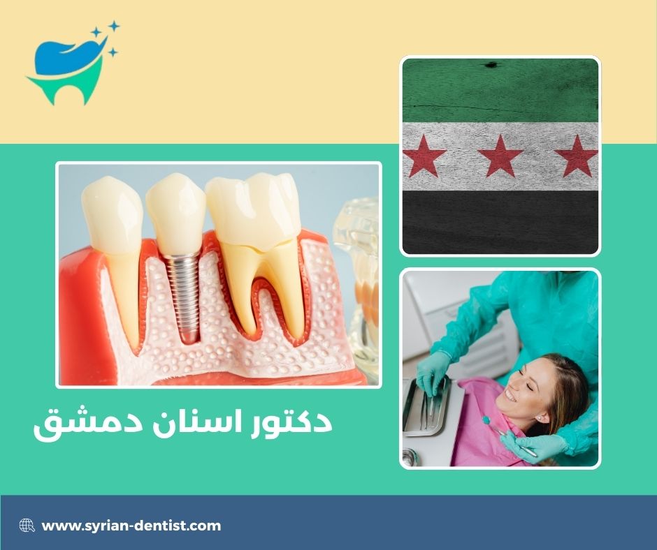 دكتور اسنان دمشق