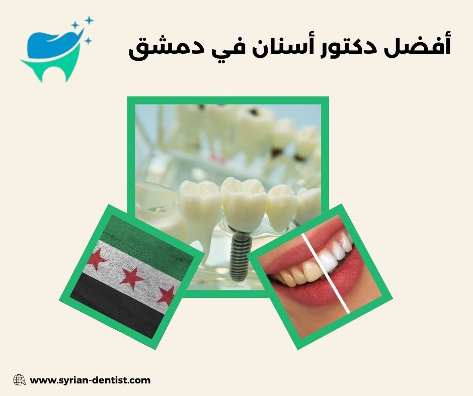 كيف تختار أفضل دكتور أسنان في دمشق؟