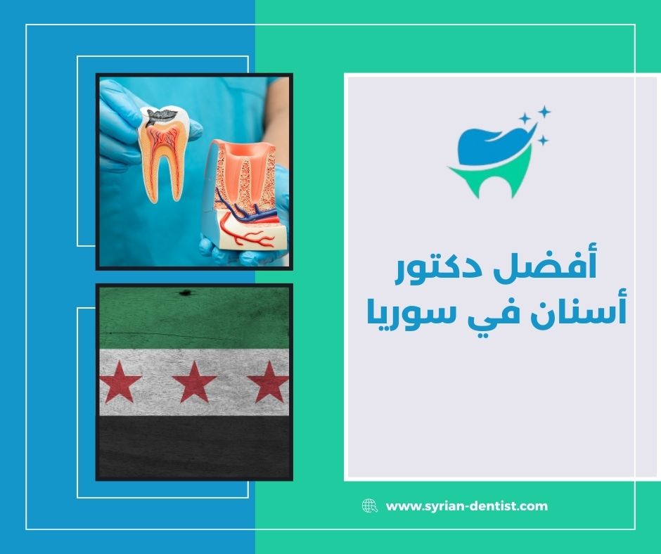 أفضل دكتور أسنان في سوريا