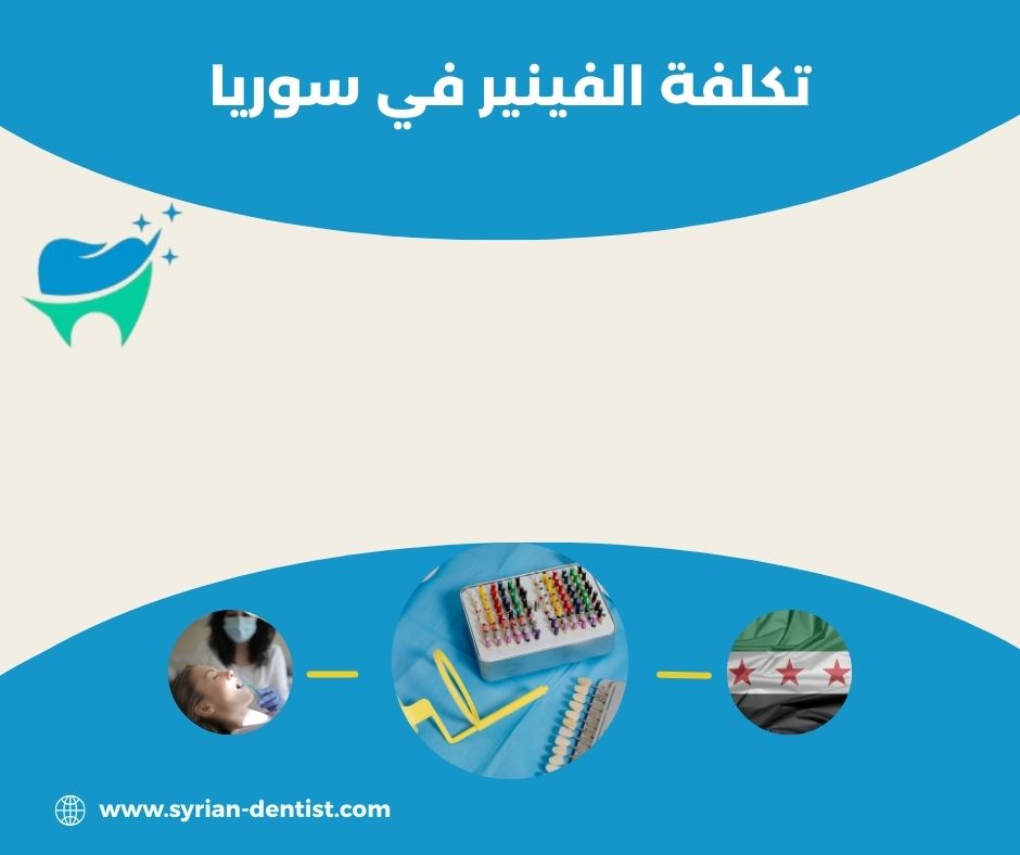 كم تبلغ تكلفة الفينير في سوريا؟