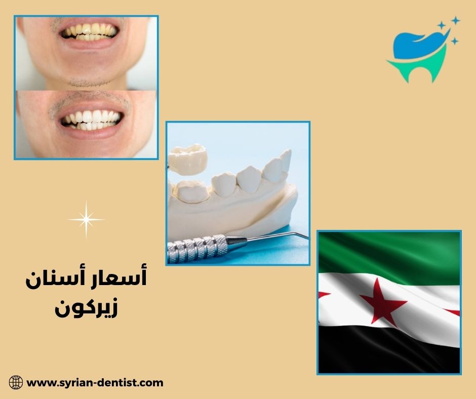 أسعار أسنان زيركون